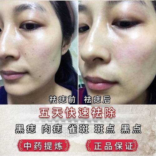 内蒙古科技大学包头医学校第二附属医院(医学美容整形科)价格表