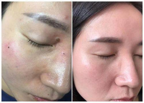 灵宝巨星医疗美容诊所擅长项目: