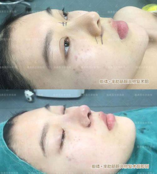 杭州梵须伽颜医疗美容诊所口碑评价：