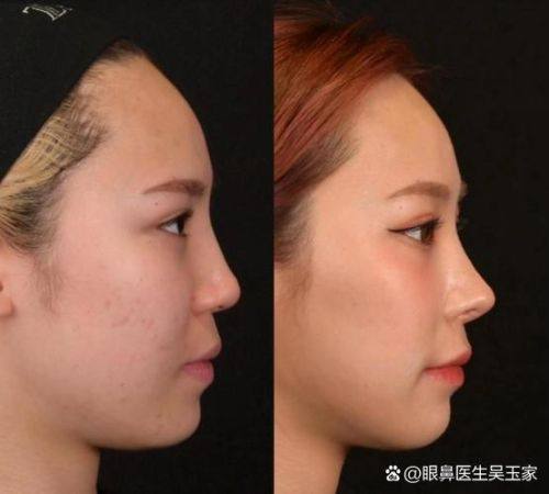 蔡博恩(Dr.Bonn)医生口碑评价