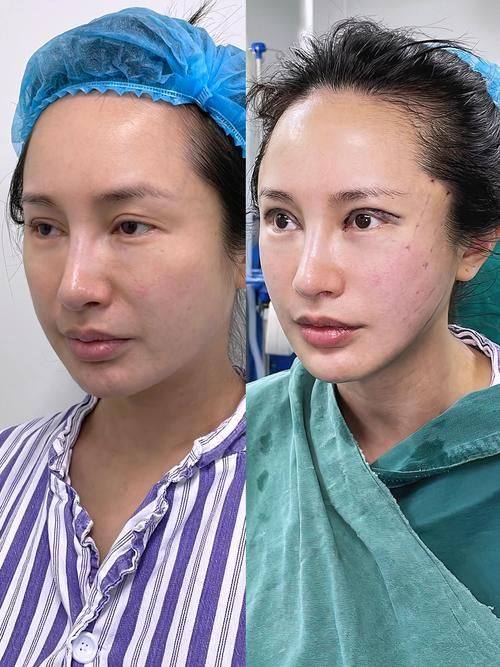 韩国心动整形医院擅长项目: