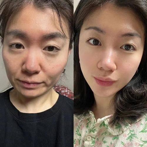 袁青医生怎么预约