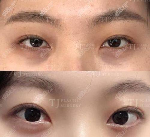 内蒙古科技大学包头医学校第二附属医院(医学美容整形科)口碑评价