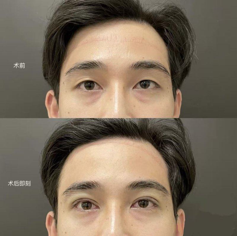 南通颜泰整形医院擅长项目: