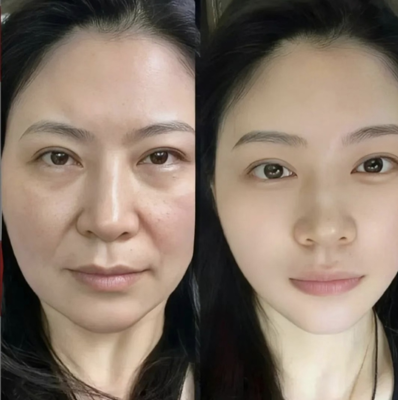 成都赵博士医疗美容医院擅长项目：