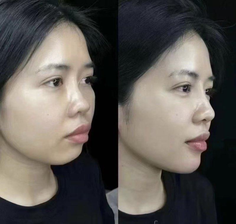 兰州美丽达整形医院预约挂号方式：