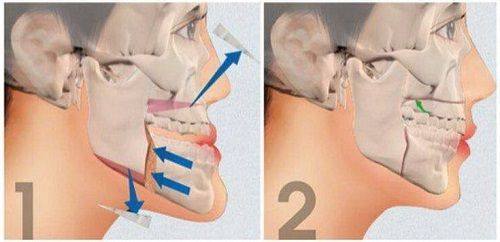 三、用眼与眼部活动的合理管控