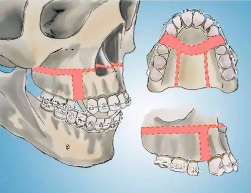 袁相斌医生口碑评价