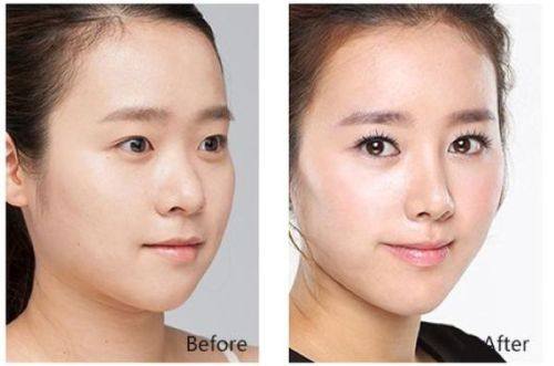 淮北苗医生祛痘祛斑美容院口碑评价