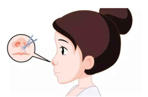 南京艺莱医疗美容医院怎么样？