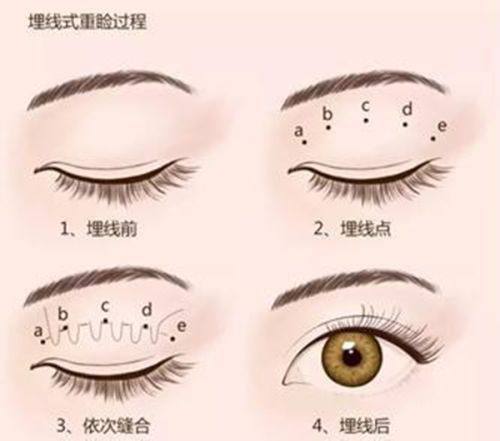 五、肿胀与淤青的针对性处理