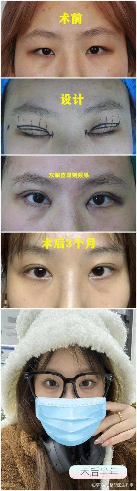 廊坊颐美佳整形医疗美容医院医生名单及擅长领域