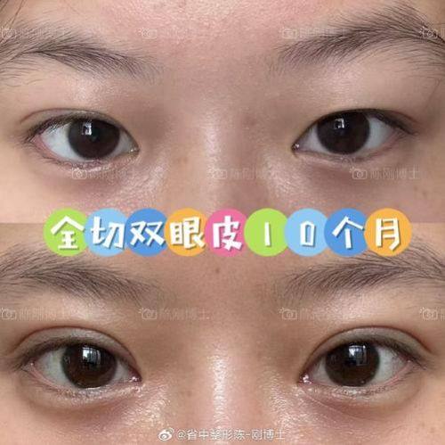 阜阳临泉残疾人修复医院口碑评价：