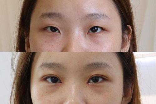 南京江宁嘉时整形医院擅长项目：