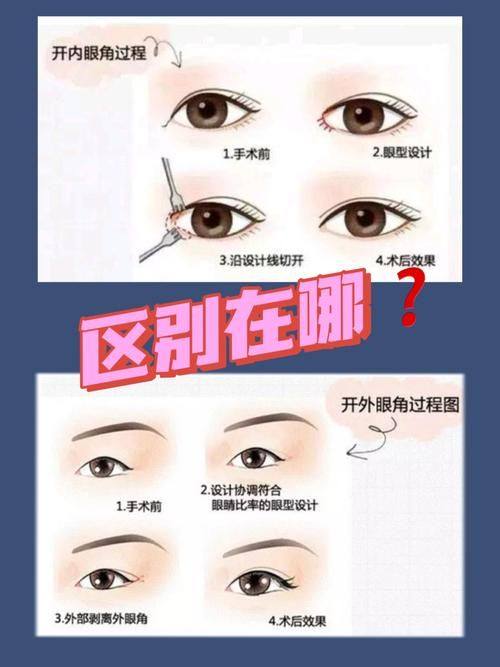 深圳雅美整形医院擅长项目：