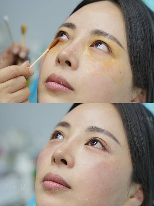 呼和浩特华医医疗美容怎么样？