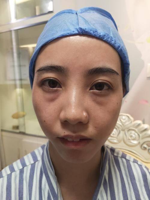 廊坊颐美佳整形医疗美容医院怎么样