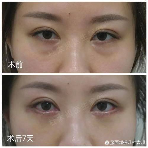 南京艺莱医疗美容医院医生名单及擅长领域：