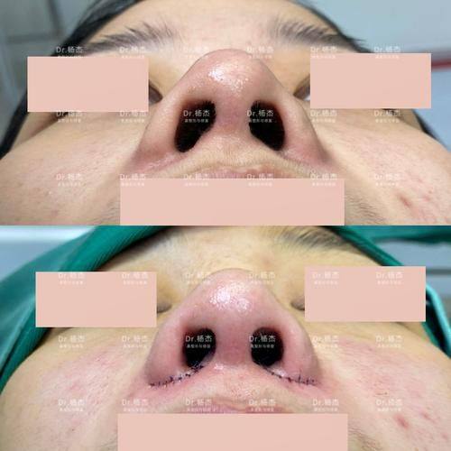 南京艺莱医疗美容医院预约挂号方式