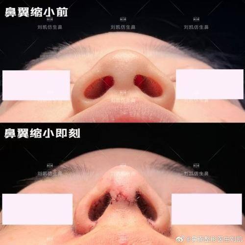 南京艺莱医疗美容医院口碑评价