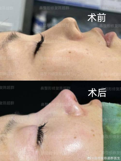 天津兰恩整形医院医生名单及擅长领域: