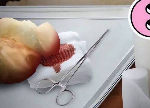 呼和浩特华医医疗美容擅长项目：