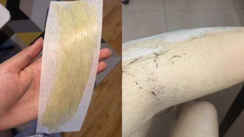 拜城县滤镜时刻整形医院口碑评价：