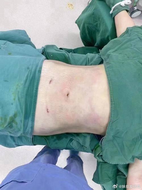 廊坊颐美佳整形医疗美容医院预约挂号方式