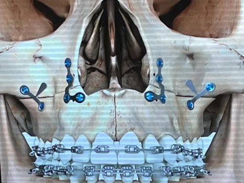 袁相斌医生擅长领域