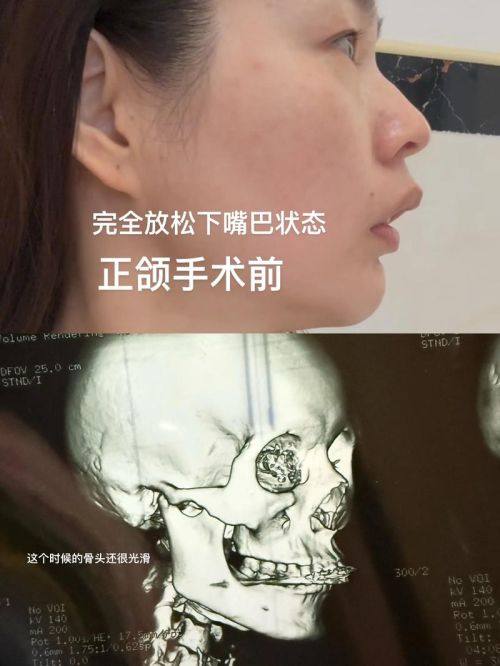 陈明辉医生擅长领域