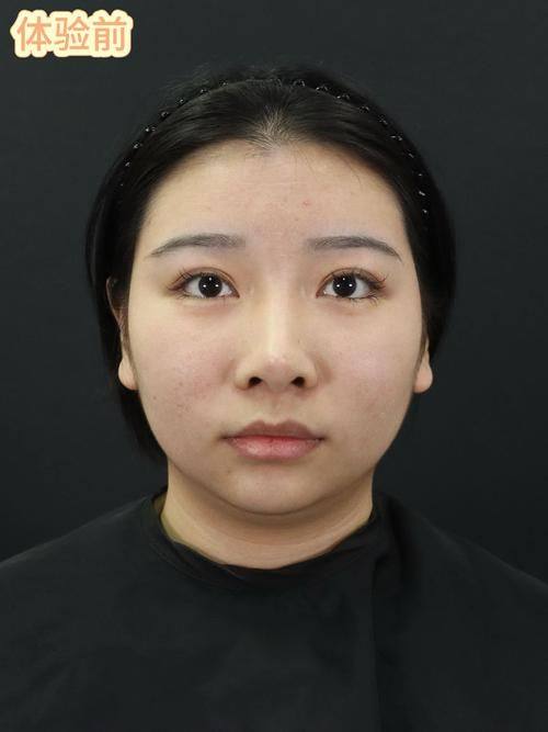 刘明宇医生技术优势