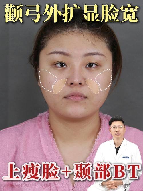 刘明宇医生口碑评价