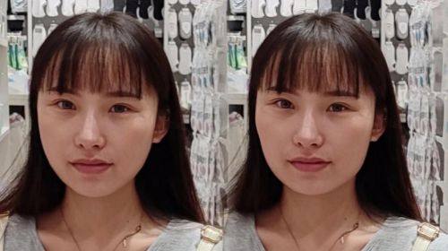 袁相斌医生技术优势