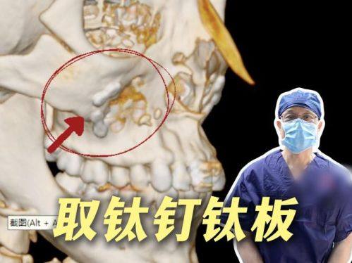 袁相斌医生怎么预约