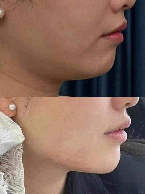 崔相哲医生口碑评价