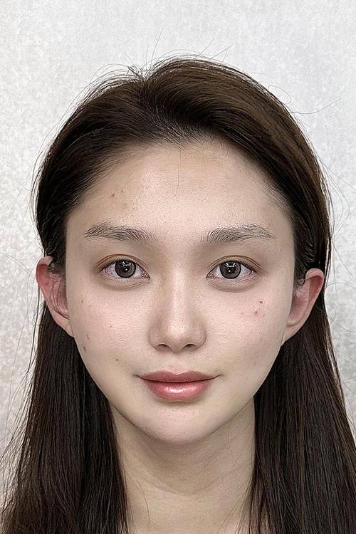 崔相哲医生怎么预约