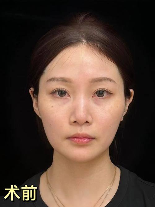 拜城县滤镜时刻整形医院预约挂号方式：