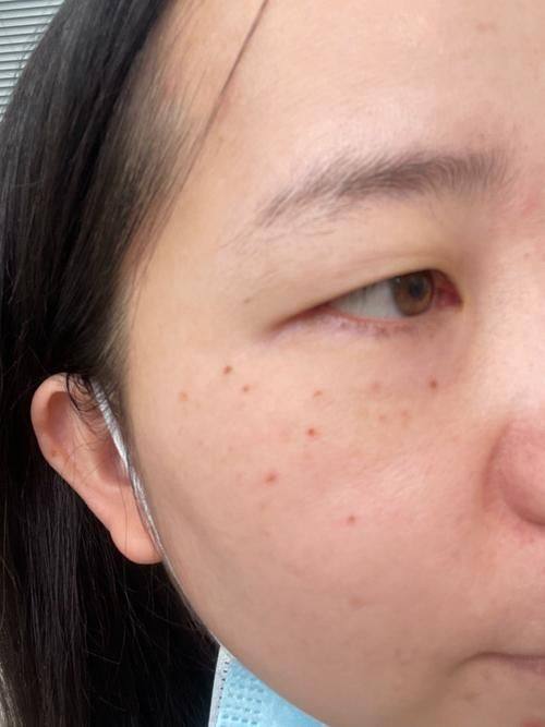 长沙叶子医疗美容医院预约挂号方式: