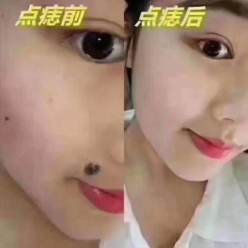 拜城县滤镜时刻整形医院怎么样？