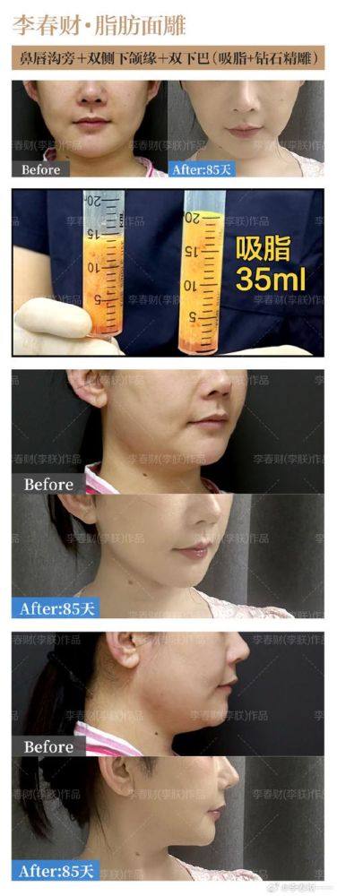 西安英格丽产康(贰捌产康)医疗美容诊所口碑评价：