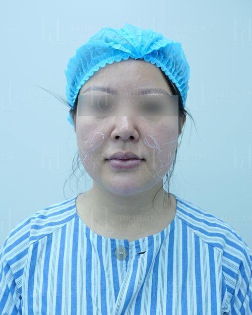 天津兰恩整形医院预约挂号方式: