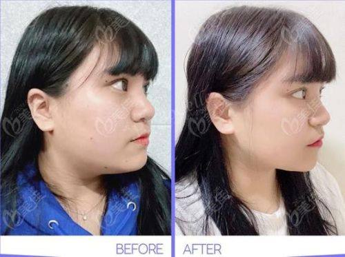 天津兰恩整形医院擅长项目: