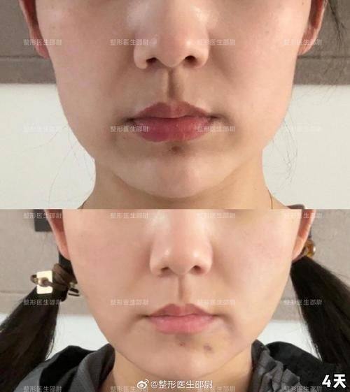 天津兰恩整形医院口碑评价: