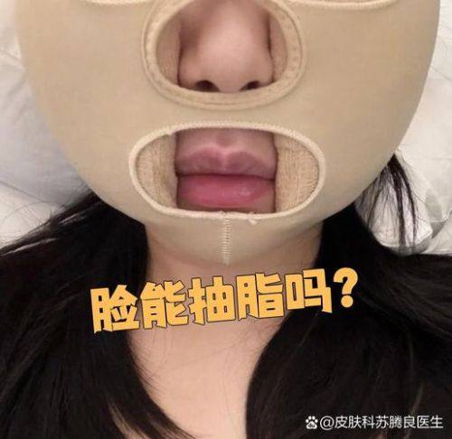 拜城县滤镜时刻整形医院价格表：