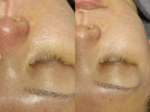 刘宾医生擅长领域