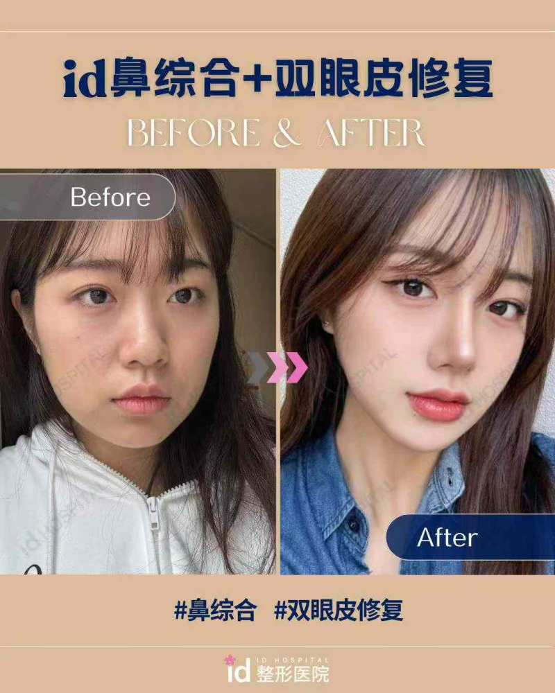 深圳雅美整形医院价格表：