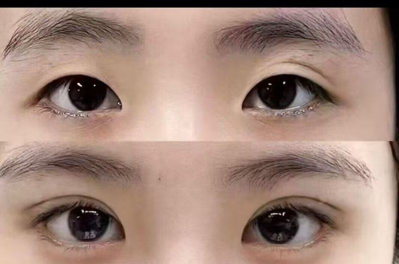 昆明盘龙华连众美医疗美容医院预约挂号方式