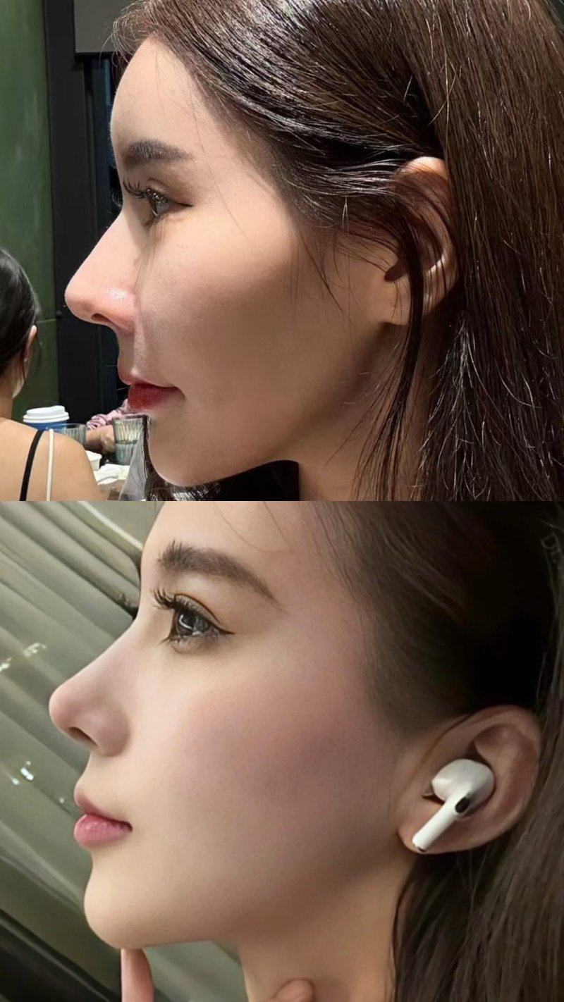 三、从“眼袋皱纹按摩手法视频”的误区，看医美改善的必要性