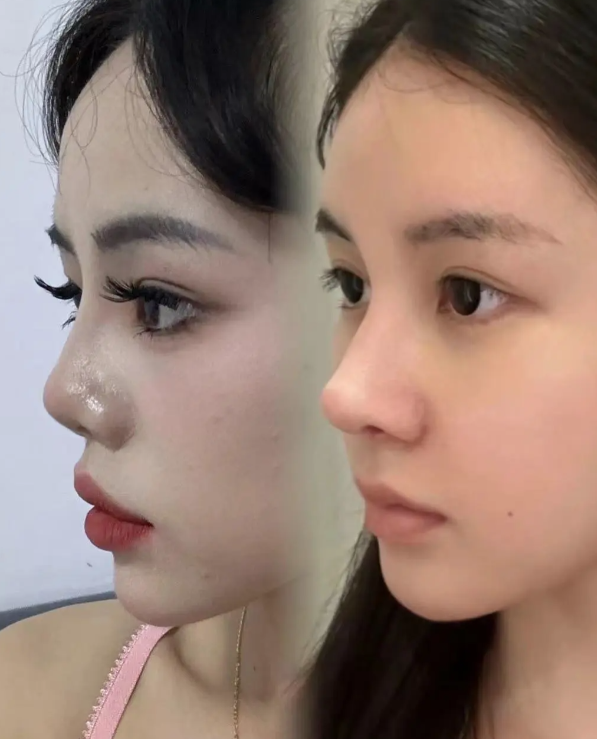 霸州淳美医疗美容诊所擅长项目：