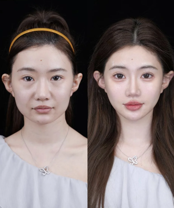 鄂州市美人邦美容生活馆擅长项目：